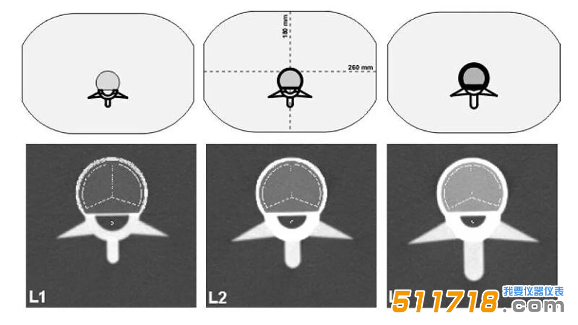 QRM-ESP 的 CT 图像。椎体中段扫描图像，并叠加了自动确定的松质骨和皮质骨 ROI。.png